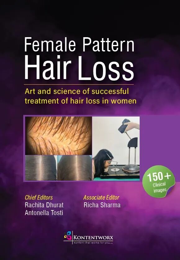 Female Pattern Hair Loss 1st Edition
