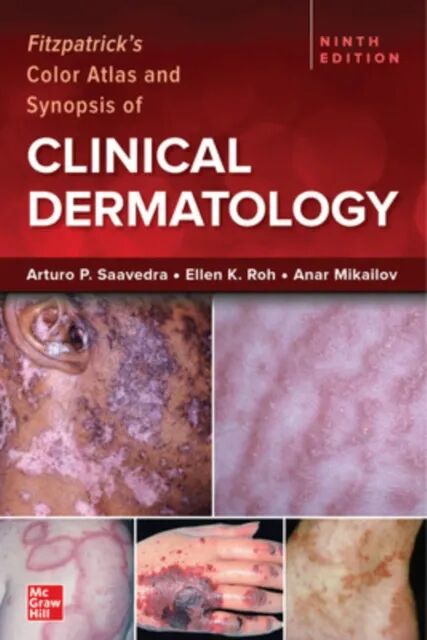 Fitzpatrick's Color Atlas and Synopsis of Clinical Dermatology 9th Edition