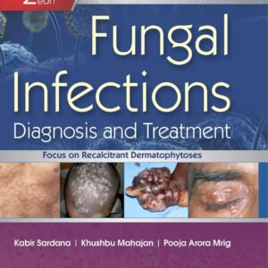 Fungal Infections Diagnosis and Treatment 2nd Edition