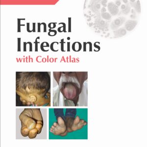 Fungal infections with Color Atlas 1st Edition