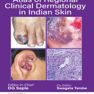 Handbook and Atlas of Regional Clinical Dermatology in Indian Skin 1st Edition