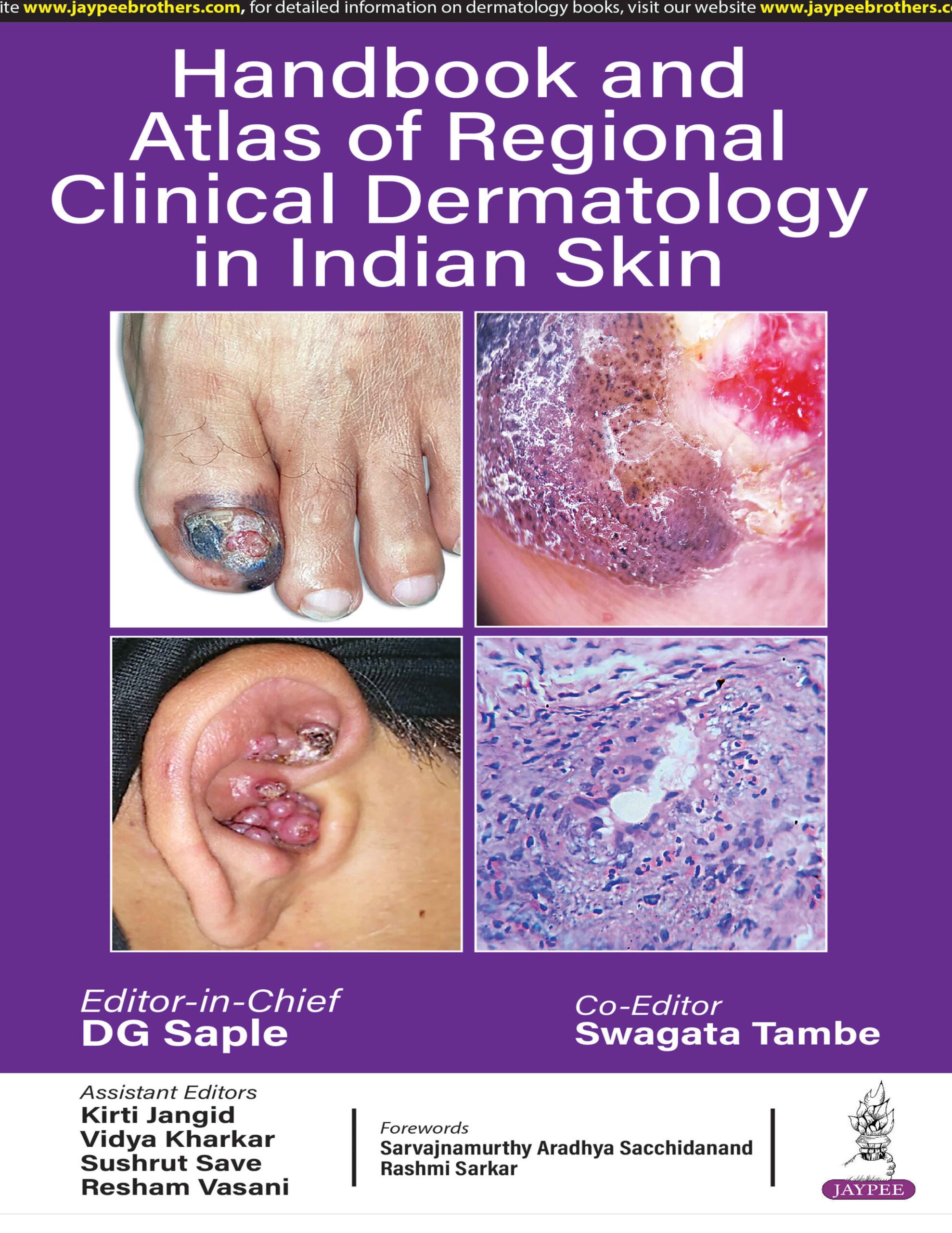 Handbook and Atlas of Regional Clinical Dermatology in Indian Skin 1st Edition