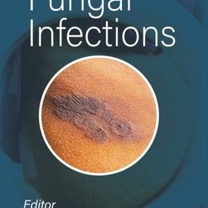 Handbook of Fungal Infections 1st Edition