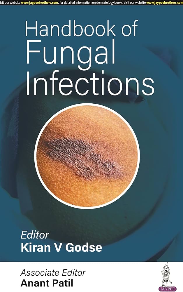 Handbook of Fungal Infections 1st Edition