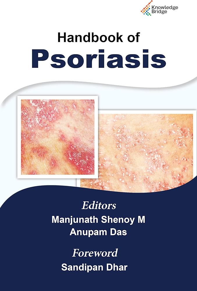 Handbook of Psoriasis 1st Edition