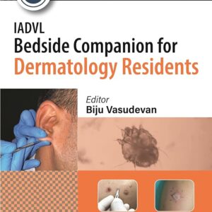 IADVL Bedside Companion for Dermatology Residents 1st Edition