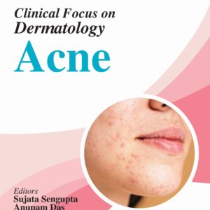 IADVL Clinical Focus on Dermatology Acne 1st Edition