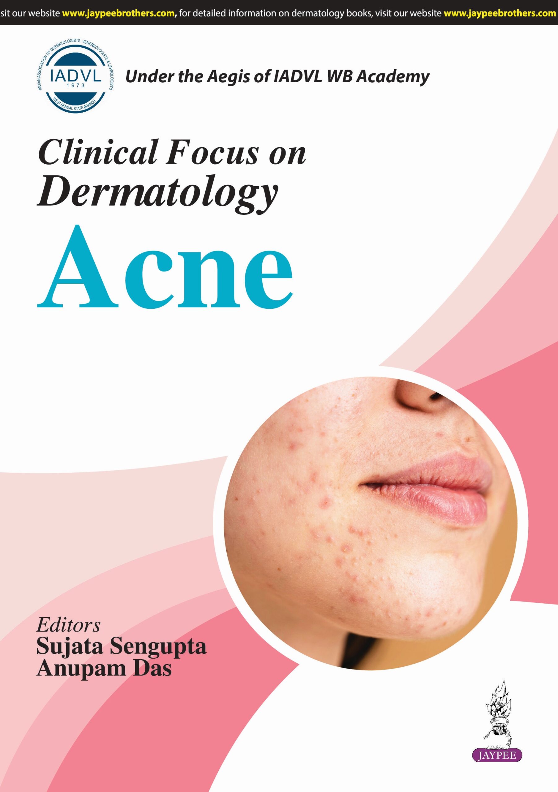 IADVL Clinical Focus on Dermatology Acne 1st Edition