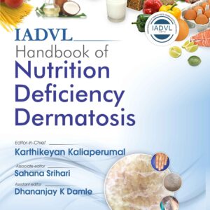 IADVL Handbook of Nutrition Deficiency Dermatosis 1st Edition