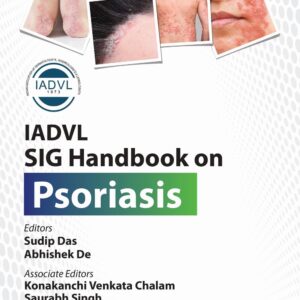 IADVL SIG Handbook on Psoriasis 1st Edition