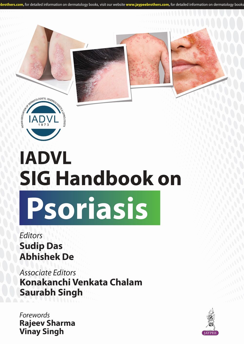 IADVL SIG Handbook on Psoriasis 1st Edition