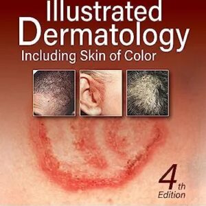 Illustrated Dermatology Including Skin of Color 4th Edition