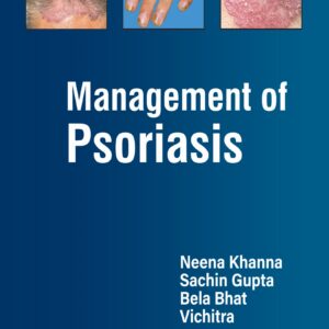 Management of Psoriasis 1st Edition