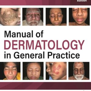 Manual of Dermatology in General Practice 2nd Edition