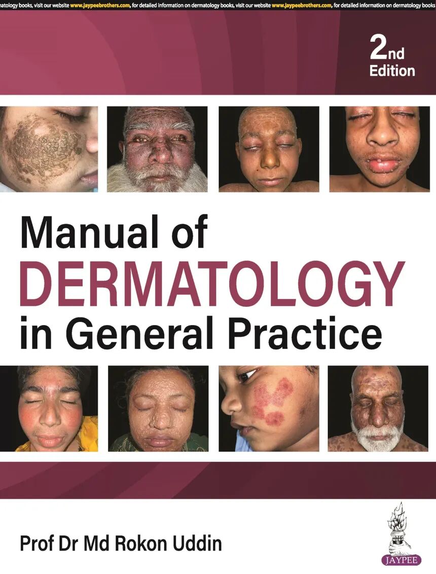 Manual of Dermatology in General Practice 2nd Edition
