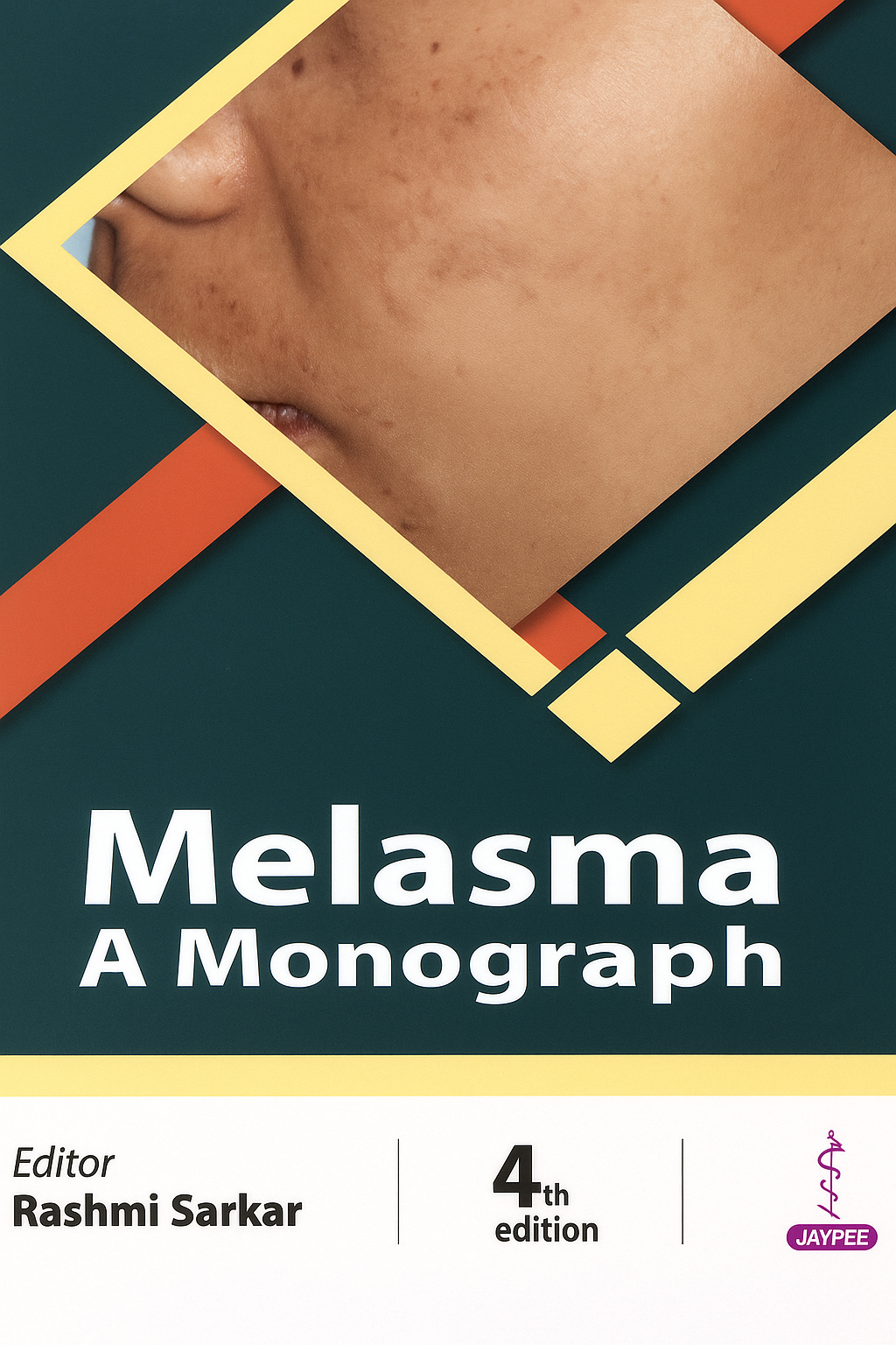 Melasma: A Monograph 4th Edition