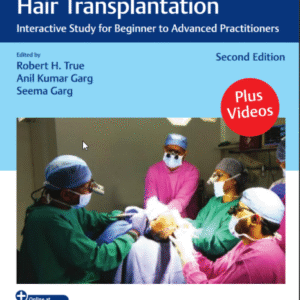 Practical Guide to Hair Transplantation 2nd Edition