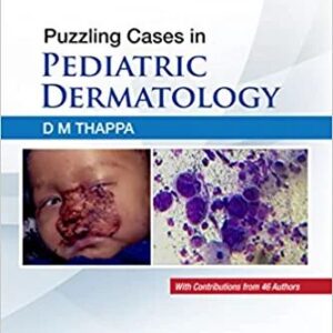 Puzzling Cases in Pediatric Dermatology 1st Edition