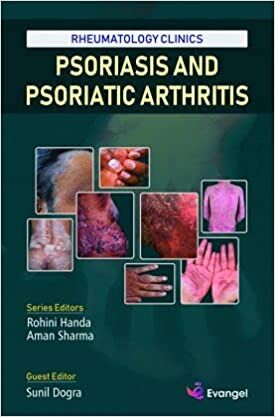 Rheumatology Clinics: Psoriasis and Psoriatic Arthritis 1st Edition