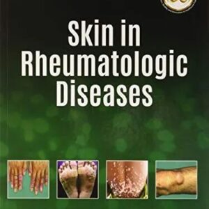 Skin in Rheumatologic Diseases 1st Edition