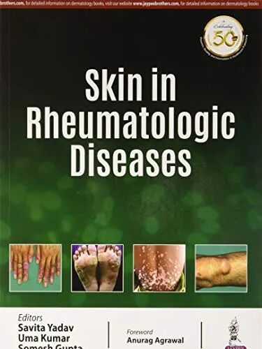 Skin in Rheumatologic Diseases 1st Edition