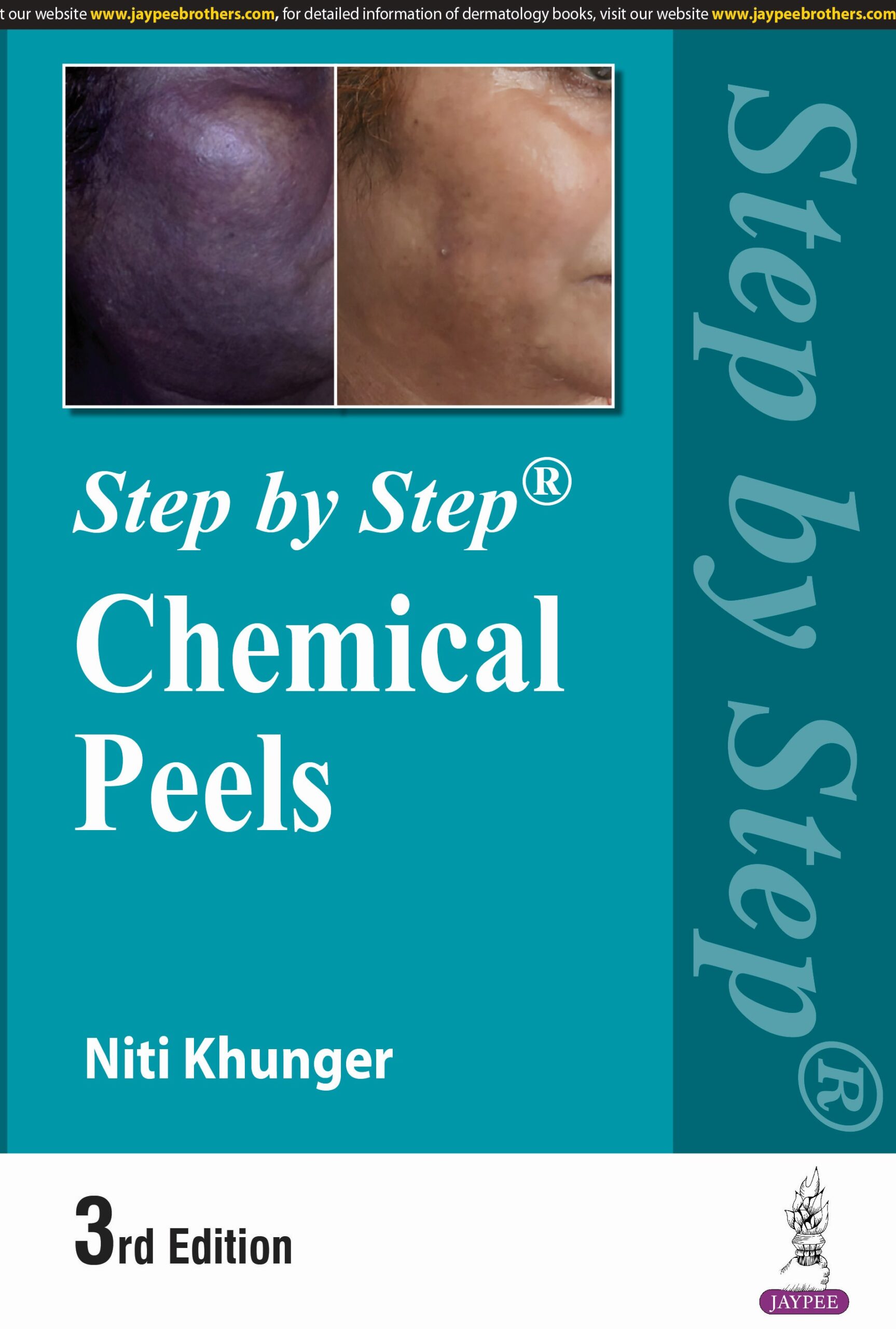 Step by Step Chemicals Peels 3rd Edition