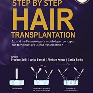 Step by Step Hair Transplantation 1st Edition
