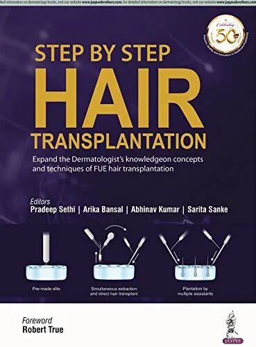Step by Step Hair Transplantation 1st Edition