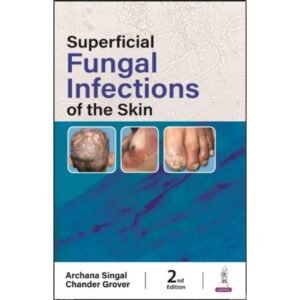 Superficial Fungal Infections of the Skin Edition