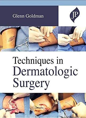 Techniques in Dermatologic Surgery 1st Edition