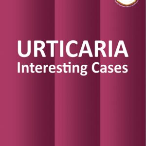 Urticaria 1st Edition