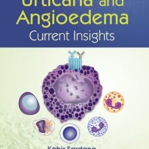 Urticaria And Angioedema Current Insights 1st Editino