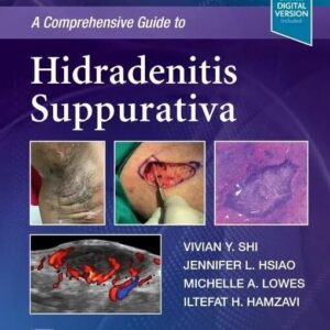 A Comprehensive Guide to Hidradenitis Suppurativa 1st Edition A Comprehensive Guide to Hidradenitis Suppurativa 1st Edition
