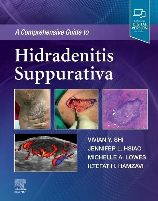 A Comprehensive Guide to Hidradenitis Suppurativa 1st Edition