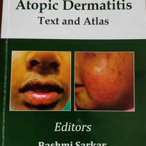 Atopic Dermatitis Text and Atlas 1st Edition