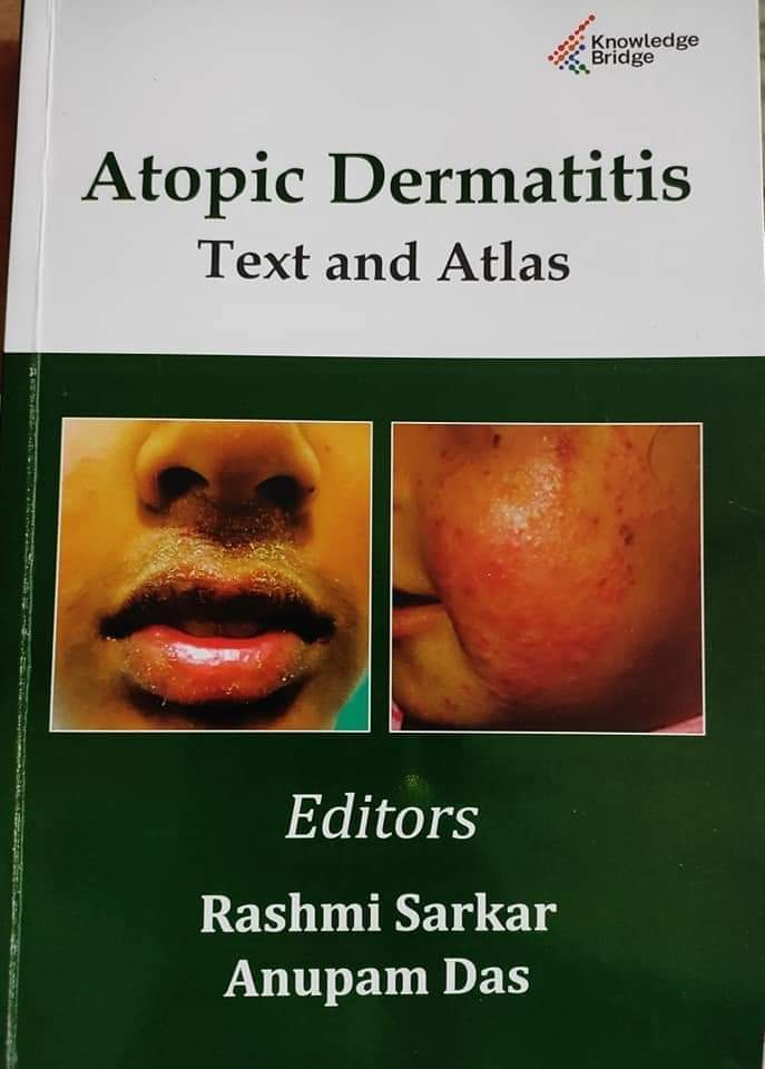 Atopic Dermatitis Text and Atlas 1st Edition