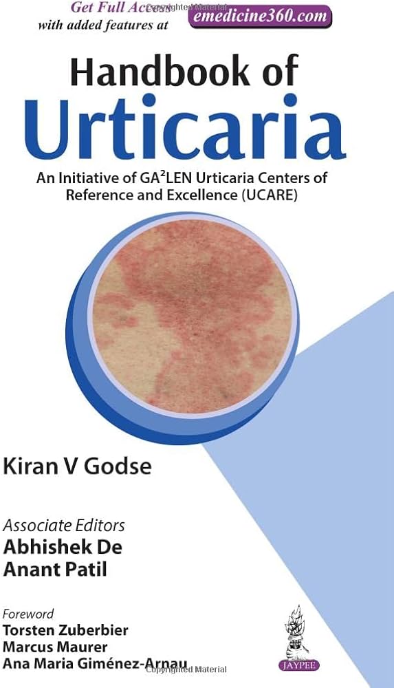 Handbook of Urticaria 1st Edition
